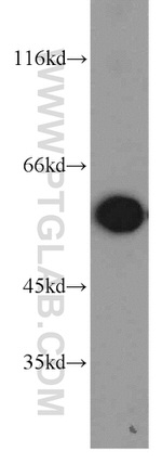 GMCL1 Antibody in Western Blot (WB)