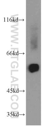 GMCL1 Antibody in Western Blot (WB)