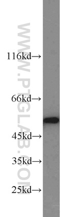 GMCL1 Antibody in Western Blot (WB)