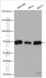 CBX2 Antibody in Western Blot (WB)
