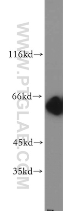 CBX2 Antibody in Western Blot (WB)