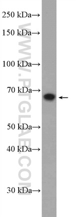 CBX2 Antibody in Western Blot (WB)