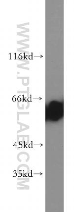CBX2 Antibody in Western Blot (WB)