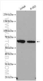 PPP3CC Antibody in Western Blot (WB)