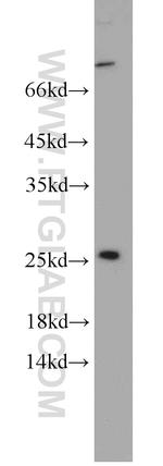 PAIP2 Antibody in Western Blot (WB)