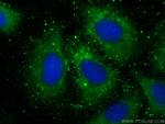 HIG2 Antibody in Immunocytochemistry (ICC/IF)