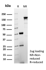 CYP2C9/Cytochrome P450 family 2 subfamily C member 9 Antibody in SDS-PAGE (SDS-PAGE)