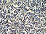 ZAP70 Antibody in Immunohistochemistry (Paraffin) (IHC (P))