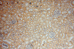 ZAP70 Antibody in Immunohistochemistry (Paraffin) (IHC (P))