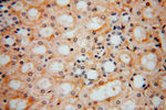 ZAP70 Antibody in Immunohistochemistry (Paraffin) (IHC (P))