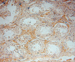 ZAP70 Antibody in Immunohistochemistry (Paraffin) (IHC (P))
