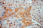 ZAP70 Antibody in Immunohistochemistry (Paraffin) (IHC (P))
