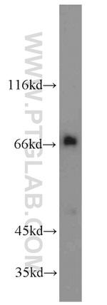 ZAP70 Antibody in Western Blot (WB)