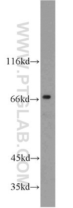 ZAP70 Antibody in Western Blot (WB)