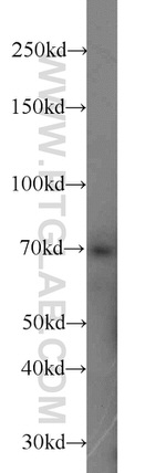 ZAP70 Antibody in Western Blot (WB)