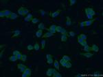 ZAP70 Antibody in Immunocytochemistry (ICC/IF)