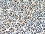 ZAP70 Antibody in Immunohistochemistry (Paraffin) (IHC (P))