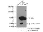 ZAP70 Antibody in Immunoprecipitation (IP)