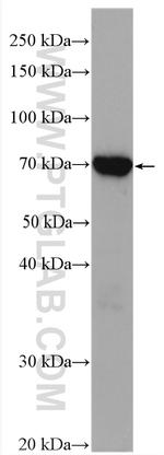ZAP70 Antibody in Western Blot (WB)