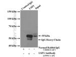 LSP1 Antibody in Immunoprecipitation (IP)