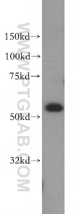 LSP1 Antibody in Western Blot (WB)
