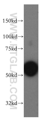 LSP1 Antibody in Western Blot (WB)