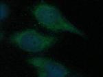 CDCA3 Antibody in Immunocytochemistry (ICC/IF)
