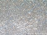 CDCA3 Antibody in Immunohistochemistry (Paraffin) (IHC (P))