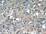 CDCA3 Antibody in Immunohistochemistry (Paraffin) (IHC (P))