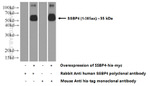 SSBP4 Antibody in Western Blot (WB)