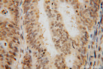 SF3A2 Antibody in Immunohistochemistry (Paraffin) (IHC (P))