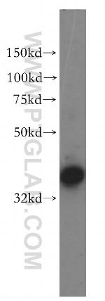 NAPG Antibody in Western Blot (WB)