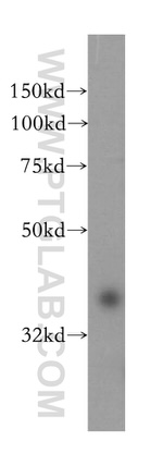 NAPG Antibody in Western Blot (WB)