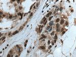VRK3 Antibody in Immunohistochemistry (Paraffin) (IHC (P))