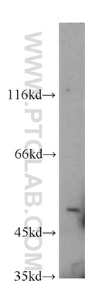 VRK3 Antibody in Western Blot (WB)