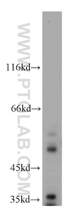 VRK3 Antibody in Western Blot (WB)
