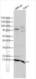 CUTA Antibody in Western Blot (WB)