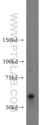 OXSR1 Antibody in Western Blot (WB)