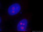 SF4 Antibody in Immunocytochemistry (ICC/IF)