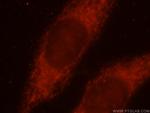 AKAP1 Antibody in Immunocytochemistry (ICC/IF)