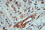 AKAP1 Antibody in Immunohistochemistry (Paraffin) (IHC (P))