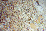 AKAP1 Antibody in Immunohistochemistry (Paraffin) (IHC (P))
