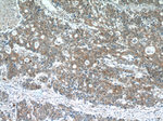 AKAP1 Antibody in Immunohistochemistry (Paraffin) (IHC (P))