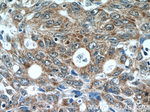 AKAP1 Antibody in Immunohistochemistry (Paraffin) (IHC (P))