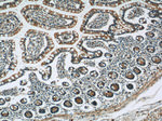 AKAP1 Antibody in Immunohistochemistry (Paraffin) (IHC (P))
