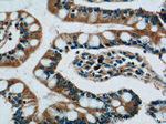AKAP1 Antibody in Immunohistochemistry (Paraffin) (IHC (P))