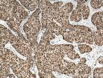 AKAP1 Antibody in Immunohistochemistry (Paraffin) (IHC (P))