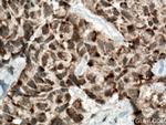 AKAP1 Antibody in Immunohistochemistry (Paraffin) (IHC (P))