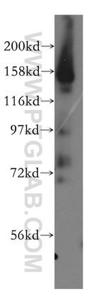 AKAP1 Antibody in Western Blot (WB)