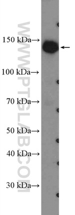 AKAP1 Antibody in Western Blot (WB)